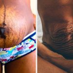 after childbirth
