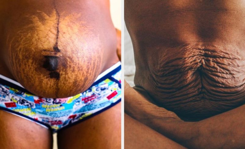 After Childbirth: Simple Ways to Stay Fit and Feel Confident Again