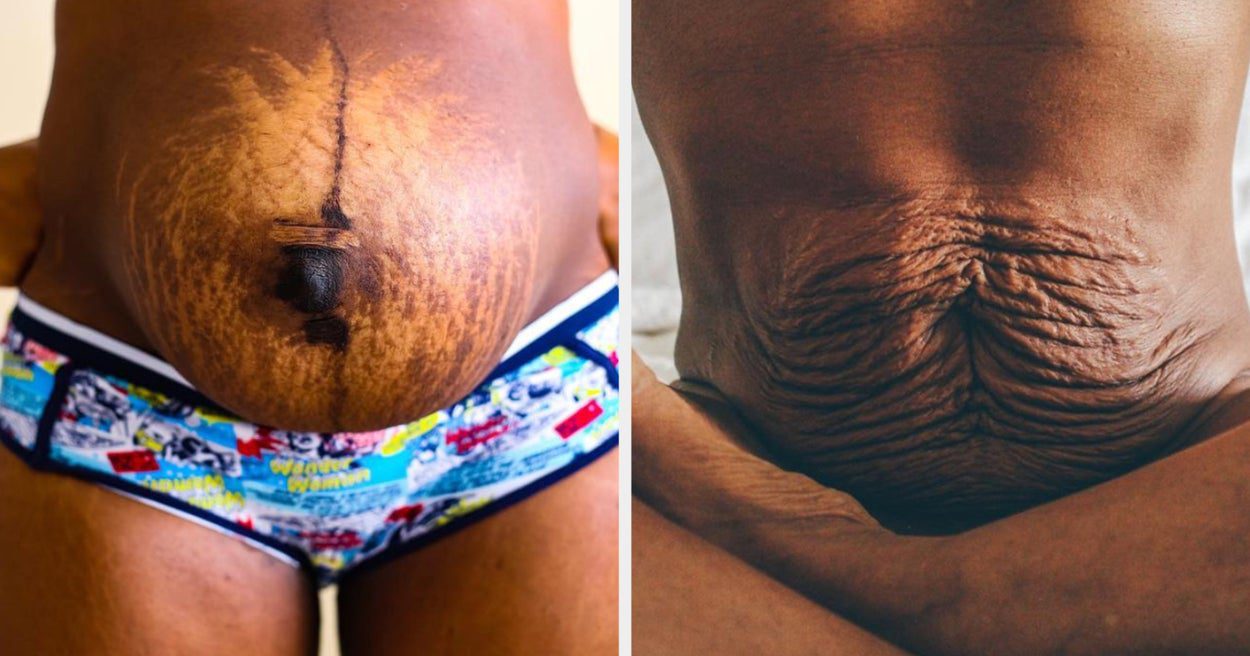 After Childbirth: Simple Ways to Stay Fit and Feel Confident Again