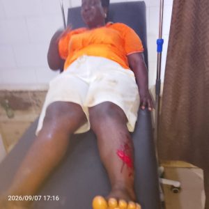 Woman beaten to coma in Kuduru 