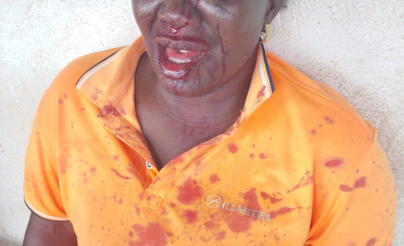 BREAKING: Woman Allegedly Beaten Into Coma in Bwari; Suspect Reportedly Bailed